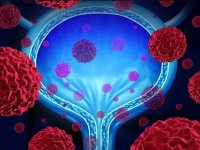 نقش مواد پروبیوتیک در عفونت‌های ادراری زنان