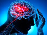 آمار سکته مغزی در ایران؛ بالاتر از میانگین جهانی؟