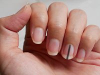 چند توصیه مهم تغذیه‌ای به مبتلایان به فشار خون