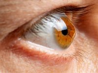 مالیدن چشم باعث قوز قرنیه می‌شود