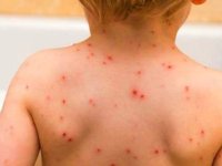 احتمال افزایش ابتلا به یک بیماری در سال جدید