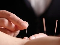طب سوزنی خطر سکته مغزی را کاهش می‌دهد؟