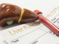 علت بالا رفتن آنزیم‌های کبدی چیست؟