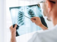 چرا آنفلوآنزا گاهی کشنده می‌شود؟