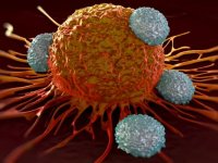 هشدار! سرطانی که در مراحل اولیه علائمی ندارد