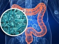 ارتباط میکروبیوم روده با یک سندرم زنانه