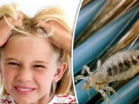 راه های خلاصی از شپش سر کدوکان