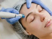 میکرونیدلینگ روش جوانسازی کم تهاجمی