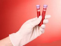 بهترین خوراکی ها برای بهبود غلظت خون