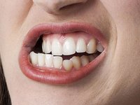 چطور دندان‌قروچه را متوقف کنیم؟