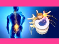 بررسی کامل دیسک کمر؛ علائم و راه‌های درمان آن