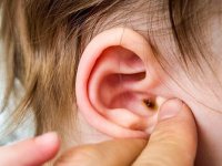 همه چیز درباره قارچ گوش و علائم ظاهری آن