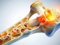 نجات از پوکی استخوان با این میوه