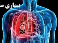 تشخیص و درمان رایگان سل در کشور