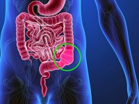 علائم، دلایل و راه‌های درمان یبوست