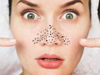 4 ماسک صورت طبیعی برای پاکسازی جوش‌های سرسیاه