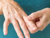 تاثیر داروی درمان آرتریت روماتوئید در پیشگیری از بیماری