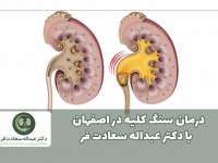 درمان سنگ کلیه در اصفهان با دکتر عبداله سعادت فر