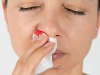 چه زمان خونریزی بینی نگران‌کننده است؟