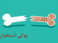 شیوع پوکی استخوان در ایران؛ روش های پیشگیری