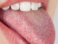 چرا دچار خشکی دهان می‌شویم؟