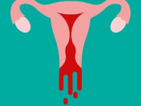 آیا خونریزی شدید قاعدگی با گیاهان دارویی قابل درمان است؟