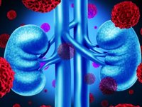 علائم آسیب و درگیری کلیه در ابتلا به کرونا
