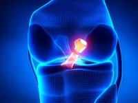علل و علائم پارگی رباط صلیبی