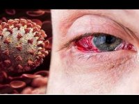 تاثیر کرونا بر بویایی و چشایی و راهکارهای درمانی آن