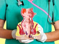 بواسیر، علل و راهکارهای درمان