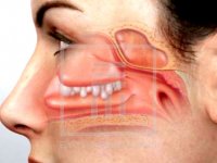 راهکارهای ساد‌‌‌‌‌‌‌ه برای رفع انسد‌‌‌‌‌‌‌‌‌‌‌‌اد‌‌‌‌‌‌‌‌‌‌‌‌ بینی