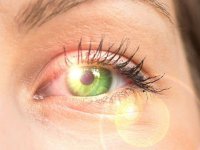 آفتاب‌سوختگی چشمی چیست؟