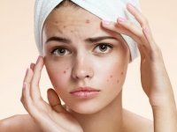 محل ایجاد جوش چه اطلاعاتی به ما می‌دهد؟