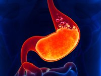 چرا در زمستان رفلاکس معده تشدید می‌شود؟