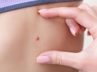 علت خارش خال چیست؟