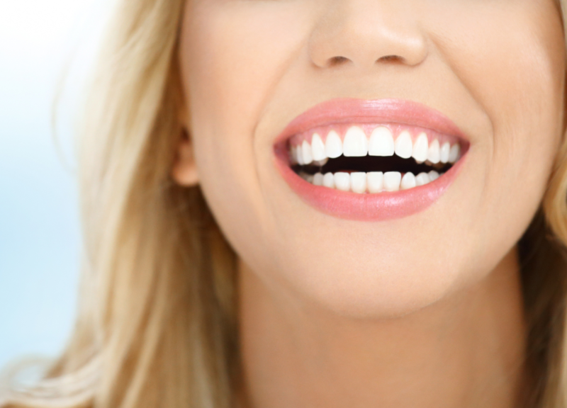 روش‌های سفید کردن دندان‌ها: نکات کاربردی برای لبخندی درخشان