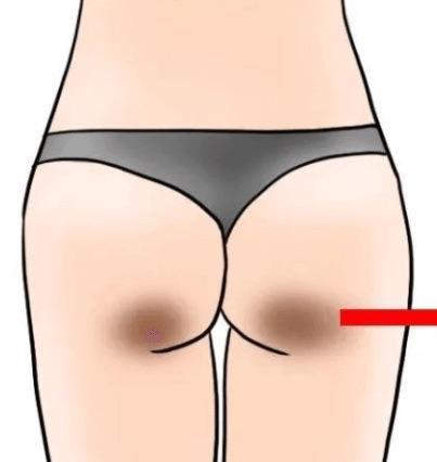 لکه های تیره